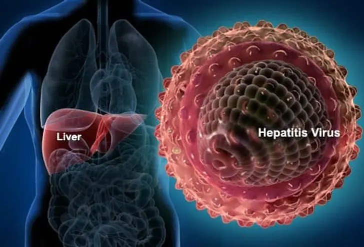 The Hidden Threat to Your Liver – What to Know About Chronic Hepatitis