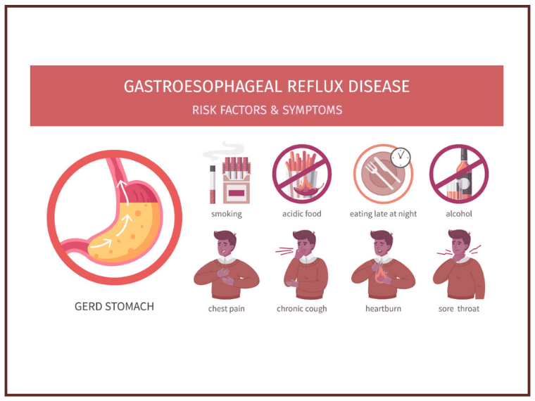 Symptoms Causes and Risk Factors of Gastro-esophageal Reflux Disease GERD Dubai