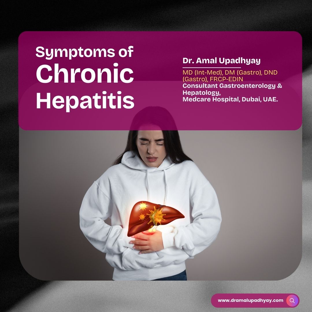 Symptoms of Chronic Hepatitis in Dubai