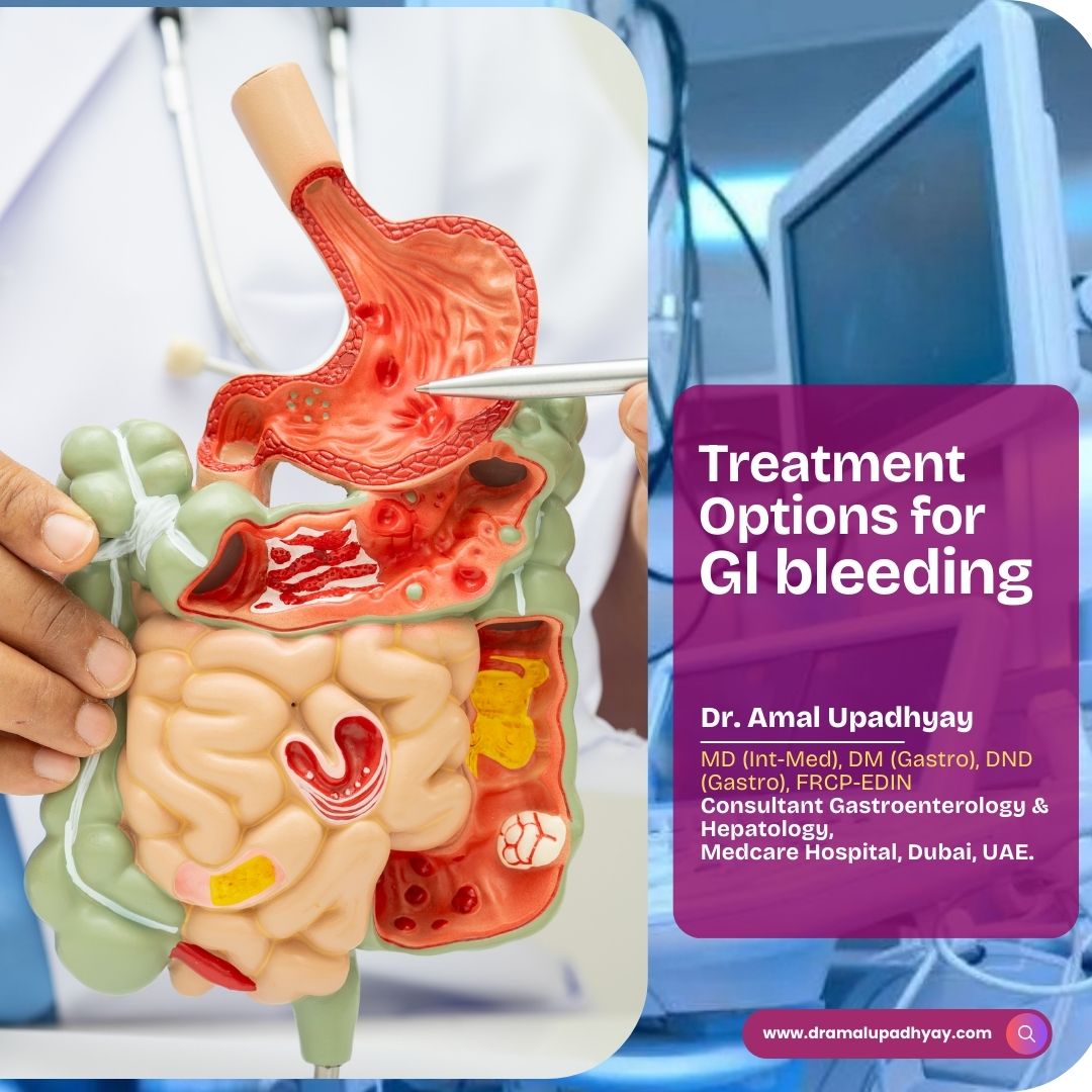 Treatment Options for GI bleeding