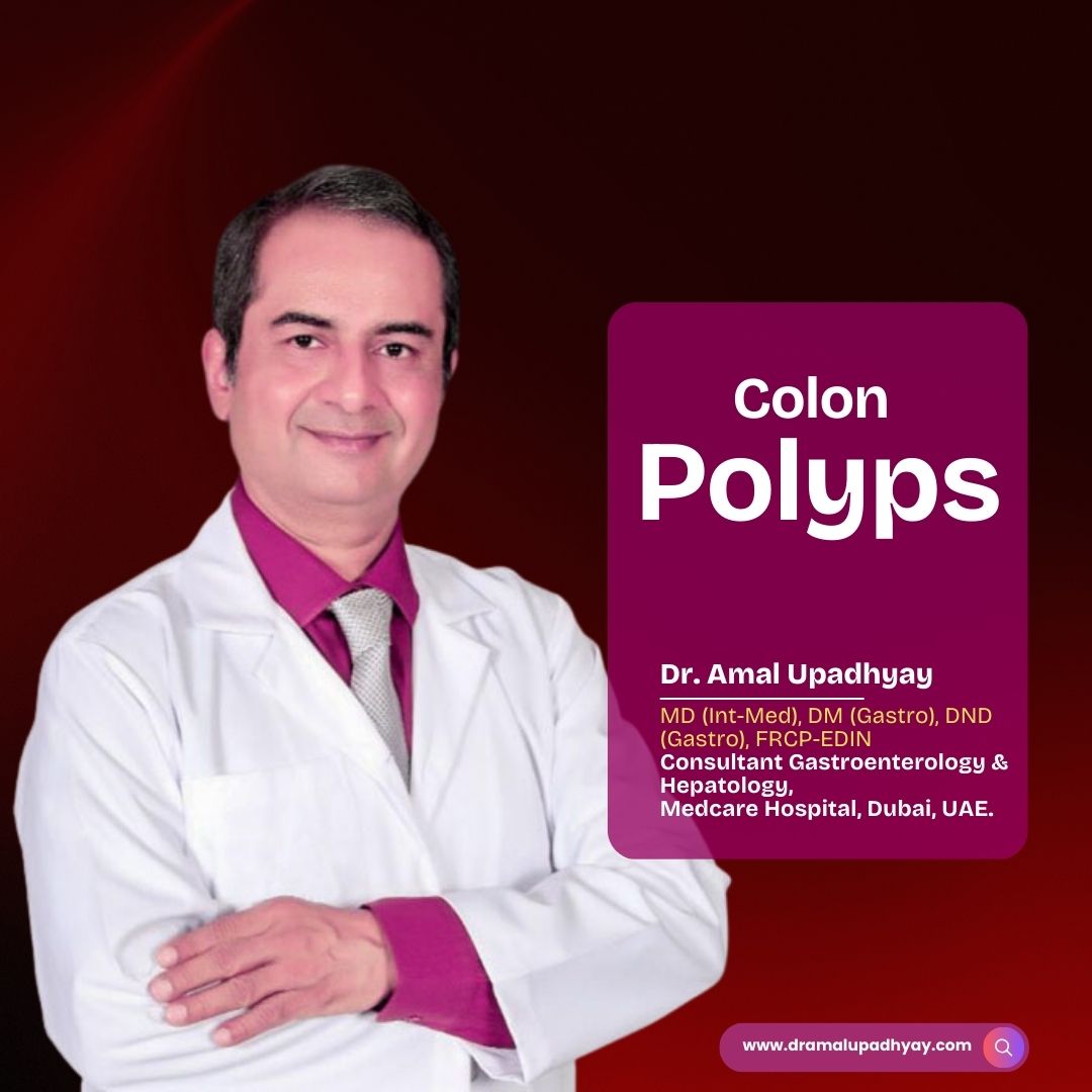 What Are Colon Polyps Dubai